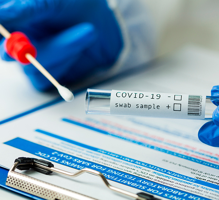Prueba molecular